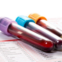 Medical Tests You Should Discuss With Your Doctor